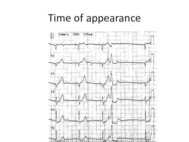 Time of appearance