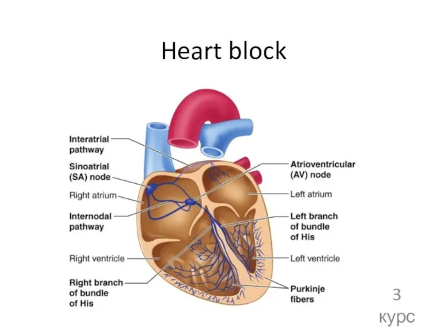 Heart block 3 курс