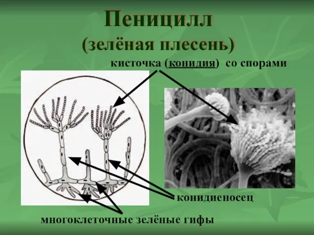 Пеницилл (зелёная плесень) кисточка (конидия) со спорами конидиеносец многоклеточные зелёные гифы