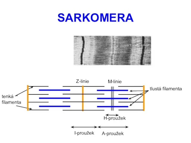 SARKOMERA Z-linie I-proužek A-proužek tlustá filamenta tenká filamenta H-proužek M-linie