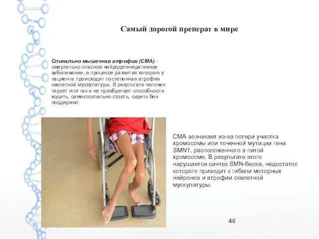 Самый дорогой преперат в мире Спинально мышечная атрофия (СМА) -смертельно опасное нейродегенеративное