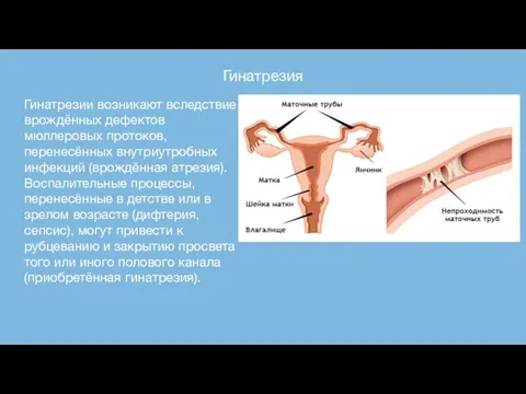 Гинатрезия Гинатрезии возникают вследствие врождённых дефектов мюллеровых протоков, перенесённых внутриутробных инфекций (врождённая