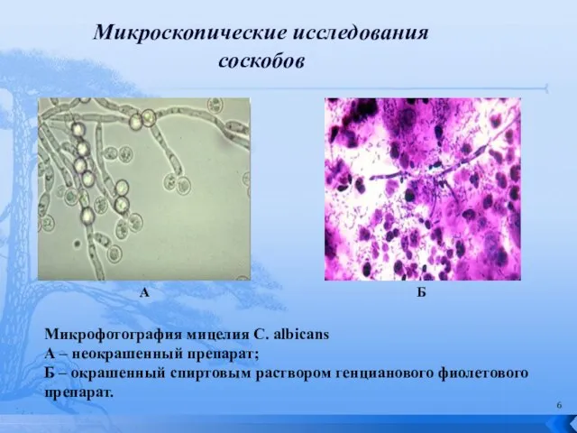 Микроскопические исследования соскобов Микрофотография мицелия C. albicans А – неокрашенный препарат; Б