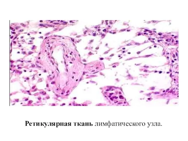 Ретикулярная ткань лимфатического узла.