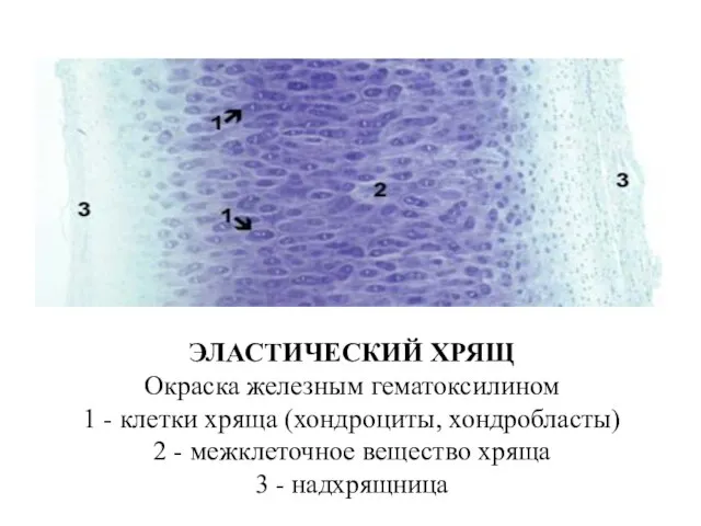 ЭЛАСТИЧЕСКИЙ ХРЯЩ Окраска железным гематоксилином 1 - клетки хряща (хондроциты, хондробласты) 2