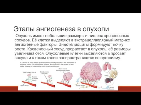 Этапы ангиогенеза в опухоли Опухоль имеет небольшие размеры и лишена кровеносных сосудов.