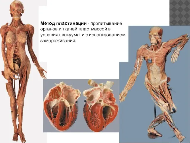 Prof. Dr. Gunter von Hagens Метод пластинации - пропитывание органов и тканей
