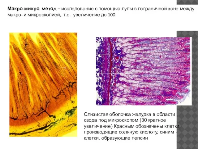 Слизистая оболочка желудка в области свода под микроскопом (30 кратное увеличение) Красным