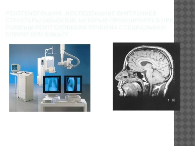 РЕНТГЕНОГРАФИЯ - ИССЛЕДОВАНИЕ ВНУТРЕННЕЙ СТРУКТУРЫ ОБЪЕКТОВ, КОТОРЫЕ ПРОЕЦИРУЮТСЯ ПРИ ПОМОЩИ РЕНТГЕНОВСКИХ ЛУЧЕЙ