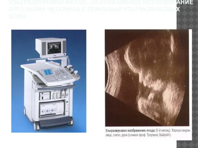 УЛЬТРАЗВУКОВОЙ МЕТОД - НЕИНВАЗИВНОЕ ИССЛЕДОВАНИЕ ОРГАНИЗМА ЧЕЛОВЕКА С ПОМОЩЬЮ УЛЬТРАЗВУКОВЫХ ВОЛН.