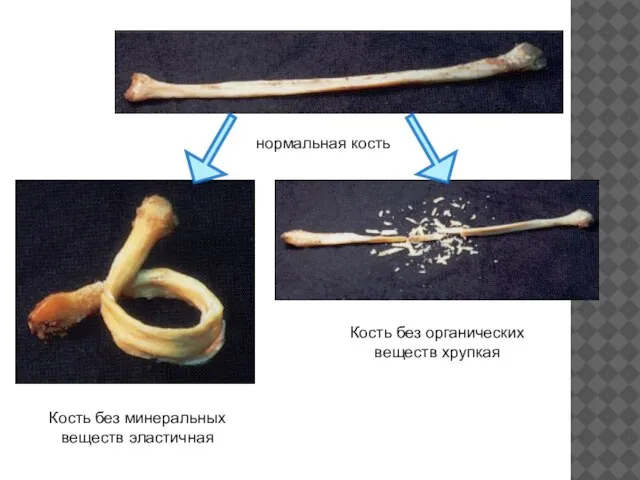 нормальная кость Кость без минеральных веществ эластичная Кость без органических веществ хрупкая