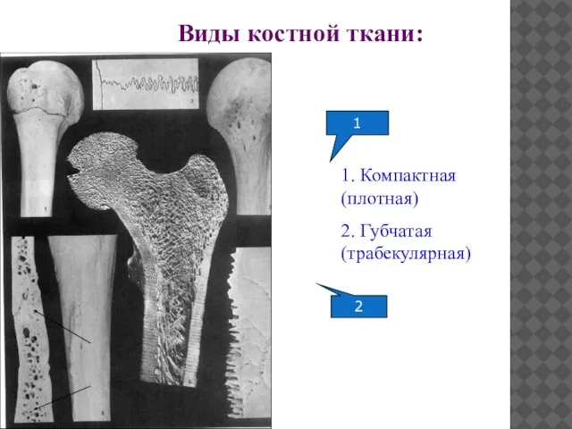 Виды костной ткани: 1. Компактная (плотная) 2. Губчатая (трабекулярная) 1 2