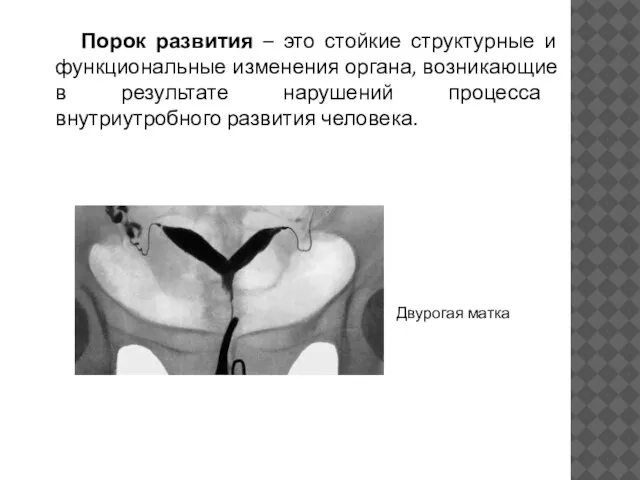 Порок развития – это стойкие структурные и функциональные изменения органа, возникающие в