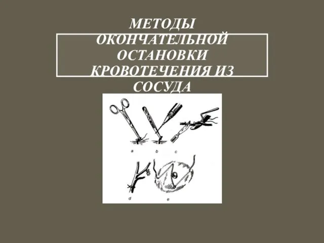 МЕТОДЫ ОКОНЧАТЕЛЬНОЙ ОСТАНОВКИ КРОВОТЕЧЕНИЯ ИЗ СОСУДА