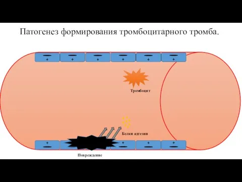 Патогенез формирования тромбоцитарного тромба. Белки адгезии Тромбоцит Повреждение