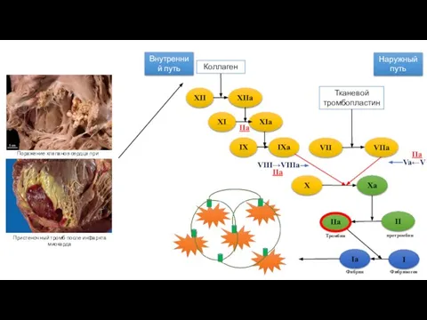 Коллаген Внутренний путь Наружный путь Тканевой тромбопластин XII XIIa XI XIa IX