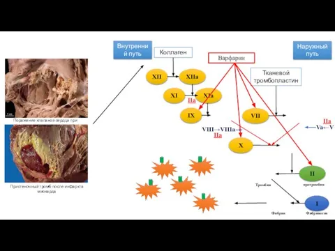 Коллаген Внутренний путь Наружный путь Тканевой тромбопластин XII XIIa XI XIa IX
