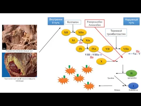 Коллаген Внутренний путь Наружный путь Тканевой тромбопластин XII XIIa XI XIa IX