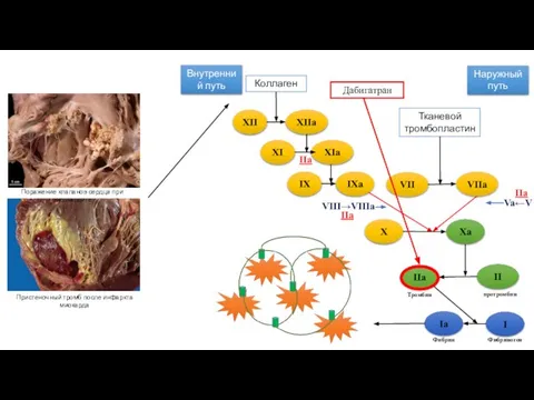 Коллаген Внутренний путь Наружный путь Тканевой тромбопластин XII XIIa XI XIa IX