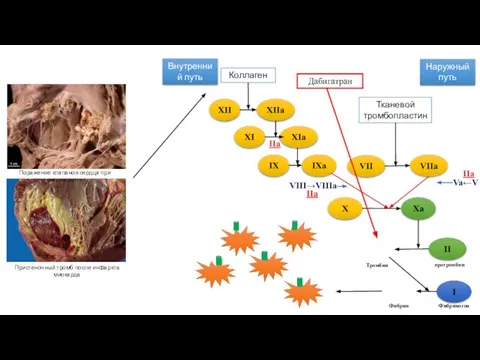 Коллаген Внутренний путь Наружный путь Тканевой тромбопластин XII XIIa XI XIa IX