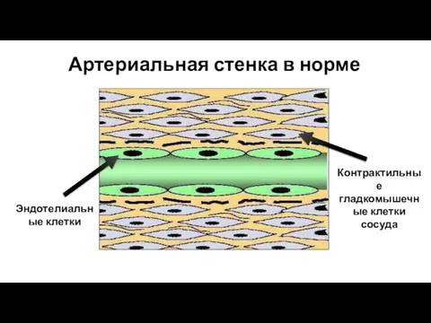 Артериальная стенка в норме Эндотелиальные клетки Контрактильные гладкомышечные клетки сосуда