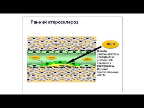 ЛПНП ↑ЛПНП ЛПНП ЛПНП