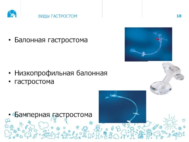 ВИДЫ ГАСТРОСТОМ Балонная гастростома Низкопрофильная балонная гастростома Бамперная гастростома