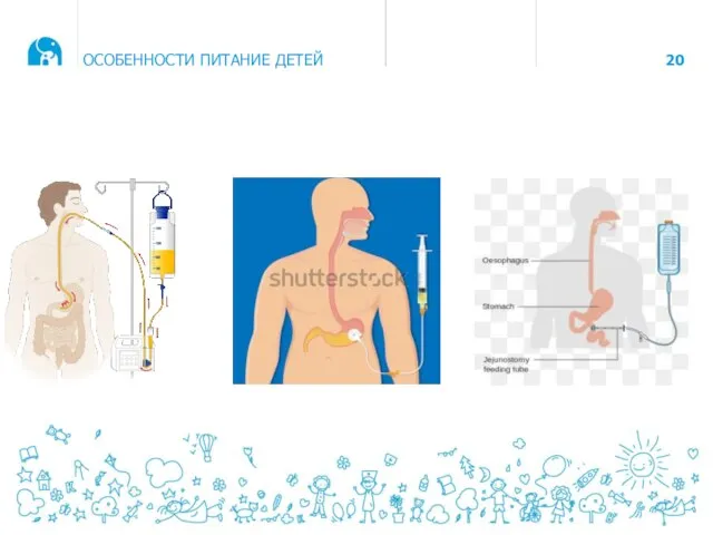 ОСОБЕННОСТИ ПИТАНИЕ ДЕТЕЙ