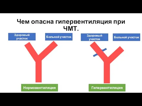 Чем опасна гипервентиляция при ЧМТ. Здоровый участок Больной участок Здоровый участок Больной участок Нормовентиляция Гипервентиляция