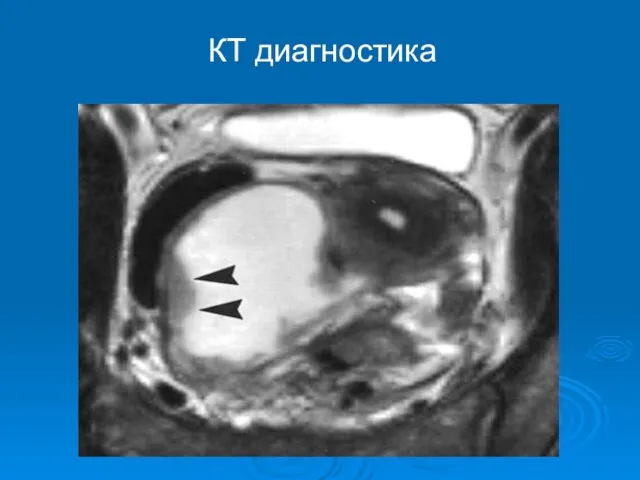 КТ диагностика