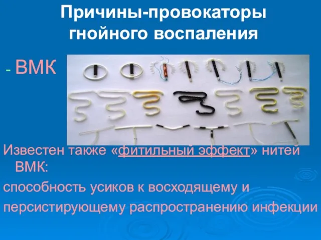 Причины-провокаторы гнойного воспаления ВМК Известен также «фитильный эффект» нитей ВМК: способность усиков