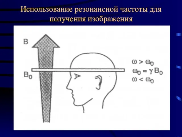 Использование резонансной частоты для получения изображения