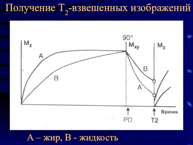 Получение Т2-взвешенных изображений А – жир, В - жидкость