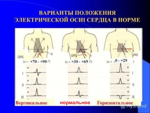 нормальное