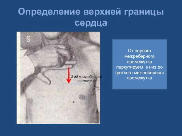 Определение верхней границы сердца От первого межреберного промежутка перкутируем в низ до