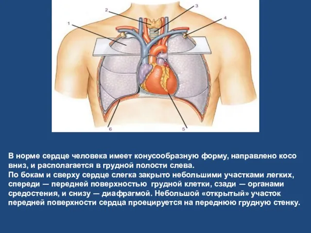 В норме сердце человека имеет конусообразную форму, направлено косо вниз, и располагается