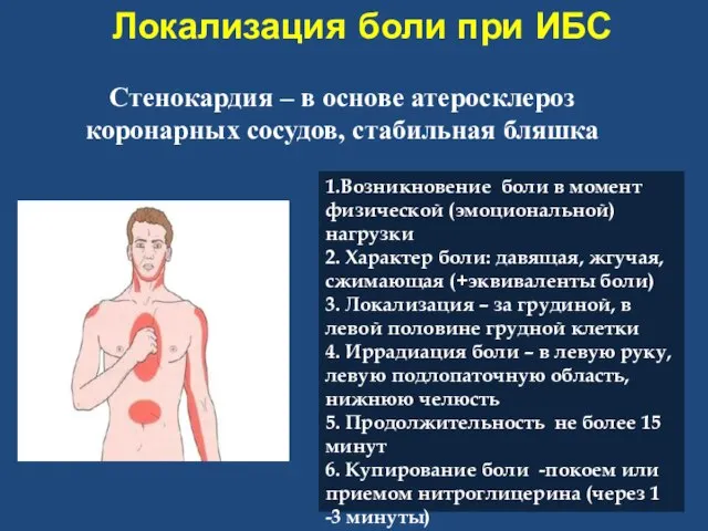 Локализация боли при ИБС Стенокардия – в основе атеросклероз коронарных сосудов, стабильная