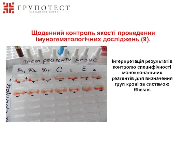 Інтерпретація результатів контролю специфічності моноклональних реагентів для визначення груп крові за системою Rhesus