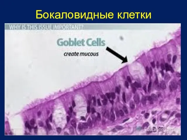 Бокаловидные клетки