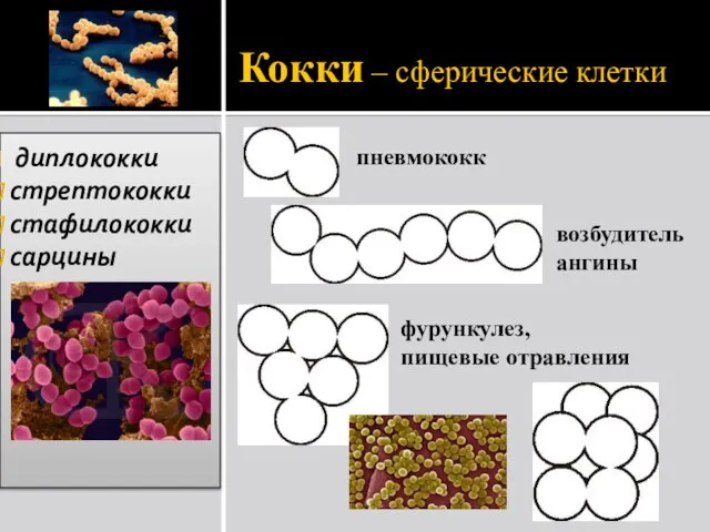 Кокки – сферические клетки диплококки стрептококки стафилококки сарцины пневмококк возбудитель ангины фурункулез, пищевые отравления