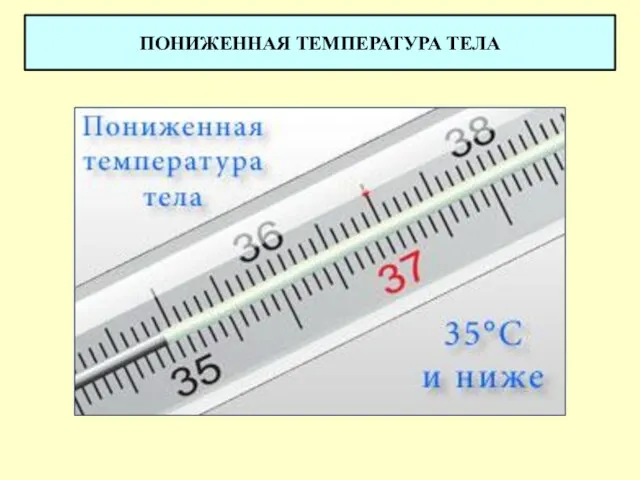 ПОНИЖЕННАЯ ТЕМПЕРАТУРА ТЕЛА