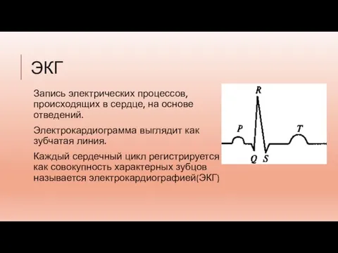 ЭКГ Запись электрических процессов, происходящих в сердце, на основе отведений. Электрокардиограмма выглядит