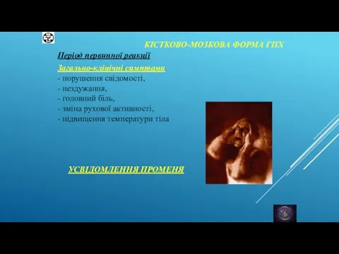 КІСТКОВО-МОЗКОВА ФОРМА ГПХ Період первинної реакції Загально-клінічні симптоми - порушення свідомості, -