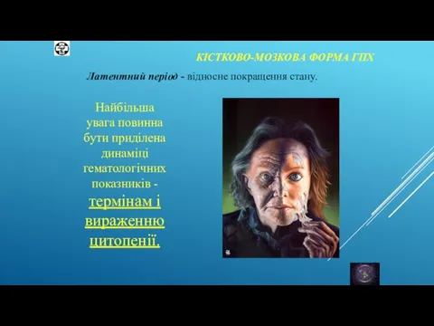 КІСТКОВО-МОЗКОВА ФОРМА ГПХ Латентний період - відносне покращення стану. Найбільша увага повинна