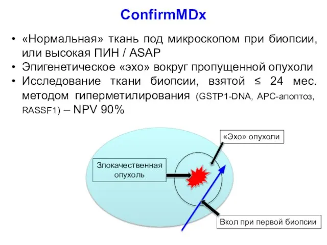 «Нормальная» ткань под микроскопом при биопсии, или высокая ПИН / ASAP Эпигенетическое