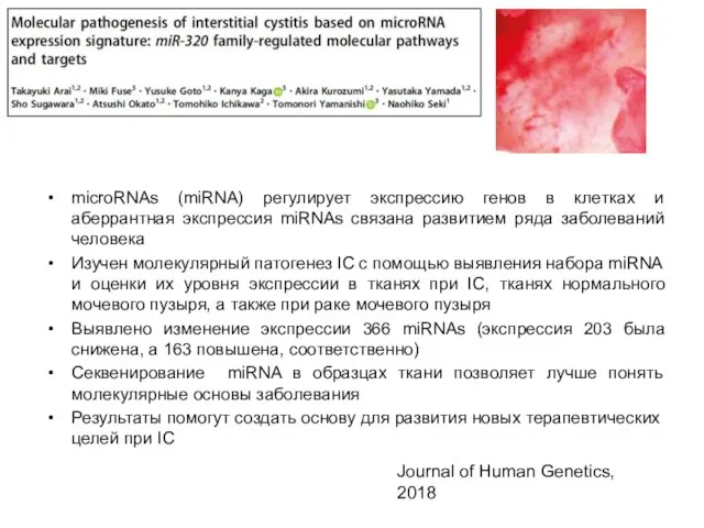 microRNAs (miRNA) регулирует экспрессию генов в клетках и аберрантная экспрессия miRNAs связана