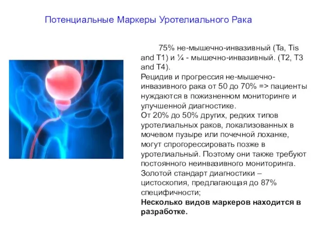 75% не-мышечно-инвазивный (Ta, Tis and T1) и ¼ - мышечно-инвазивный. (T2, T3