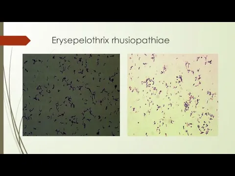 Erysepelothrix rhusiopathiae