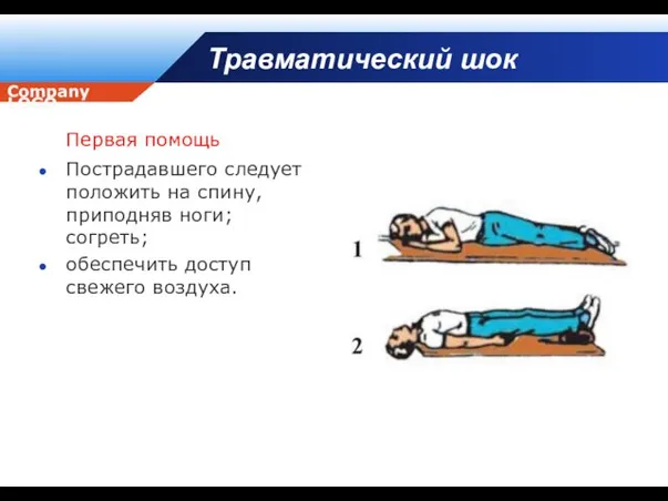 Травматический шок Первая помощь Пострадавшего следует положить на спину, приподняв ноги; согреть; обеспечить доступ свежего воздуха.