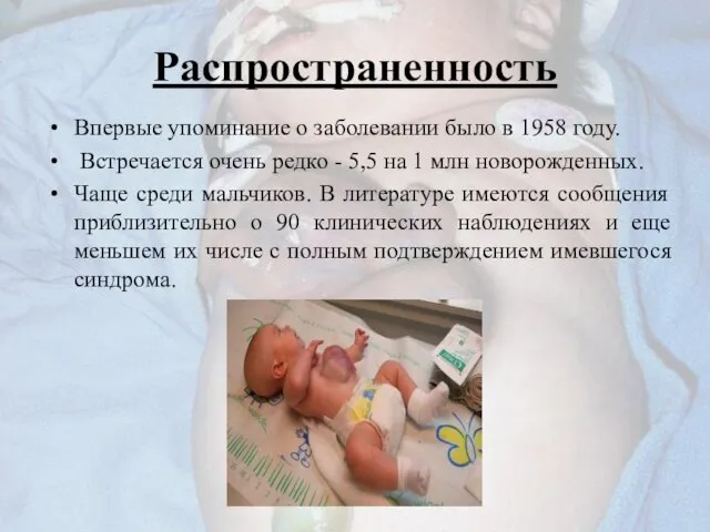 Распространенность Впервые упоминание о заболевании было в 1958 году. Встречается очень редко